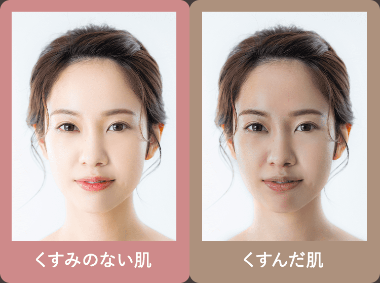 くすみBA