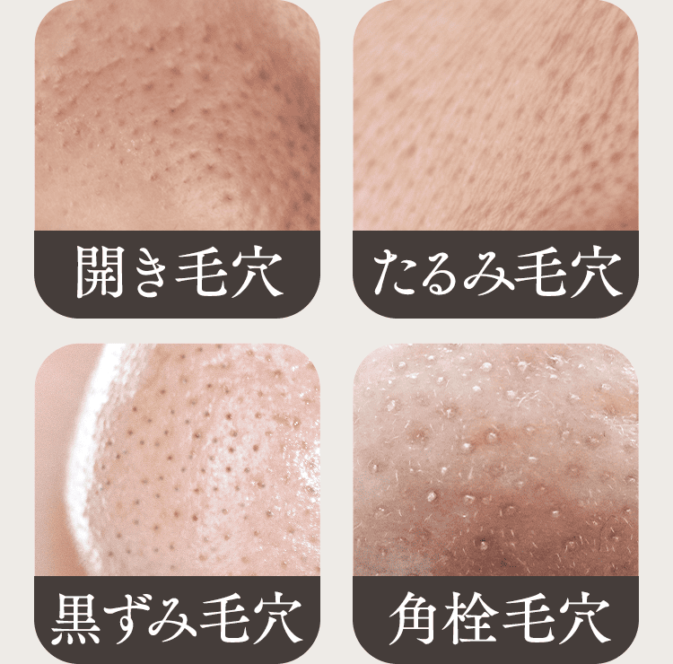 毛穴トラブル